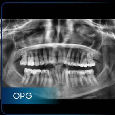 Available Services in OPG X-ray