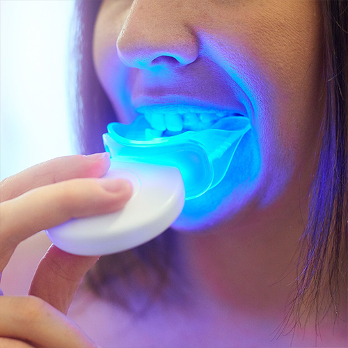 Teeth Whitening Zenith Dentistry 0689